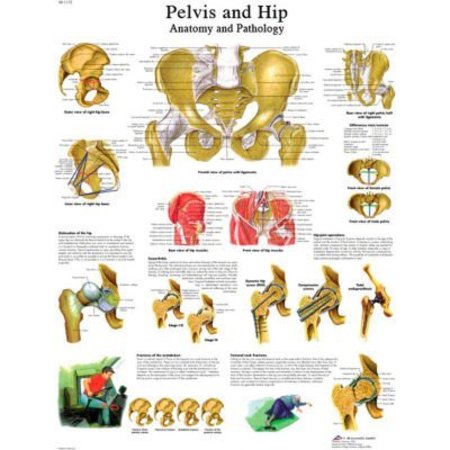 FABRICATION ENTERPRISES 3B® Anatomical Chart - Hip & Pelvis, Paper 12-4617P